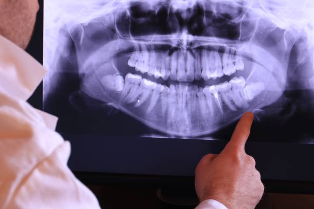 Best Orthodontic Emergency Dentist in Dalzell, SC